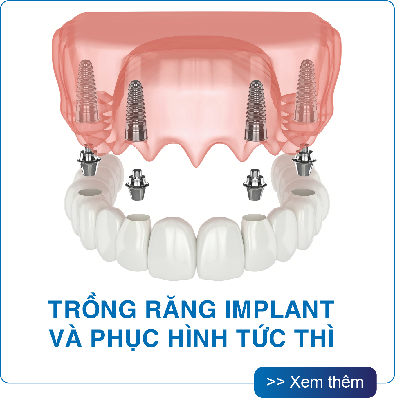 San Dentist Homepage v1