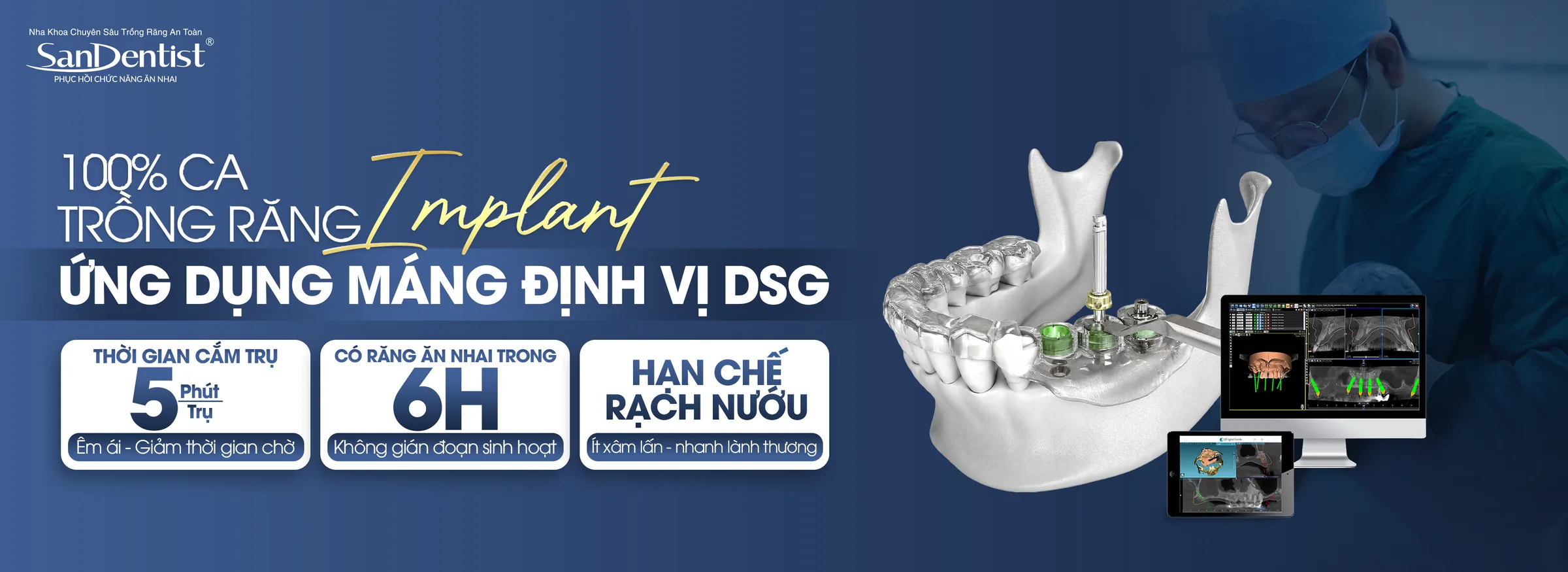 100% ca trồng răng Implant ứng dụng máng định vị DSG tại San Dentist