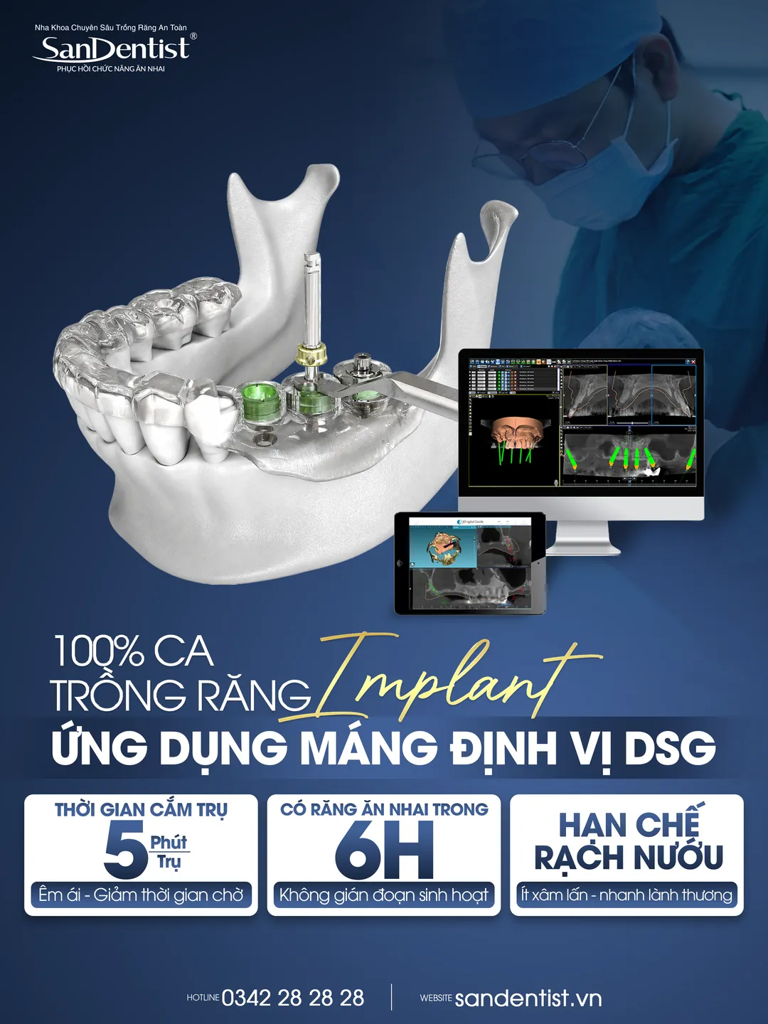100% ca trồng răng Implant ứng dụng máng định vị DSG tại San Dentist