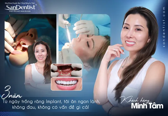 Cảm nhận khách hàng Chị Minh Tâm tại San Dentist