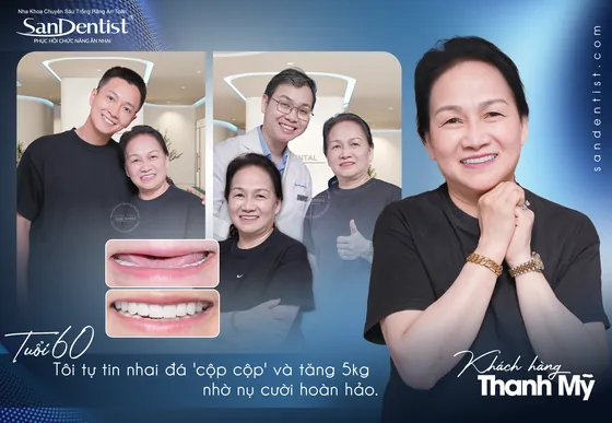 Cảm nhận khách hàng Cô Thanh Mỹ tại San Dentist