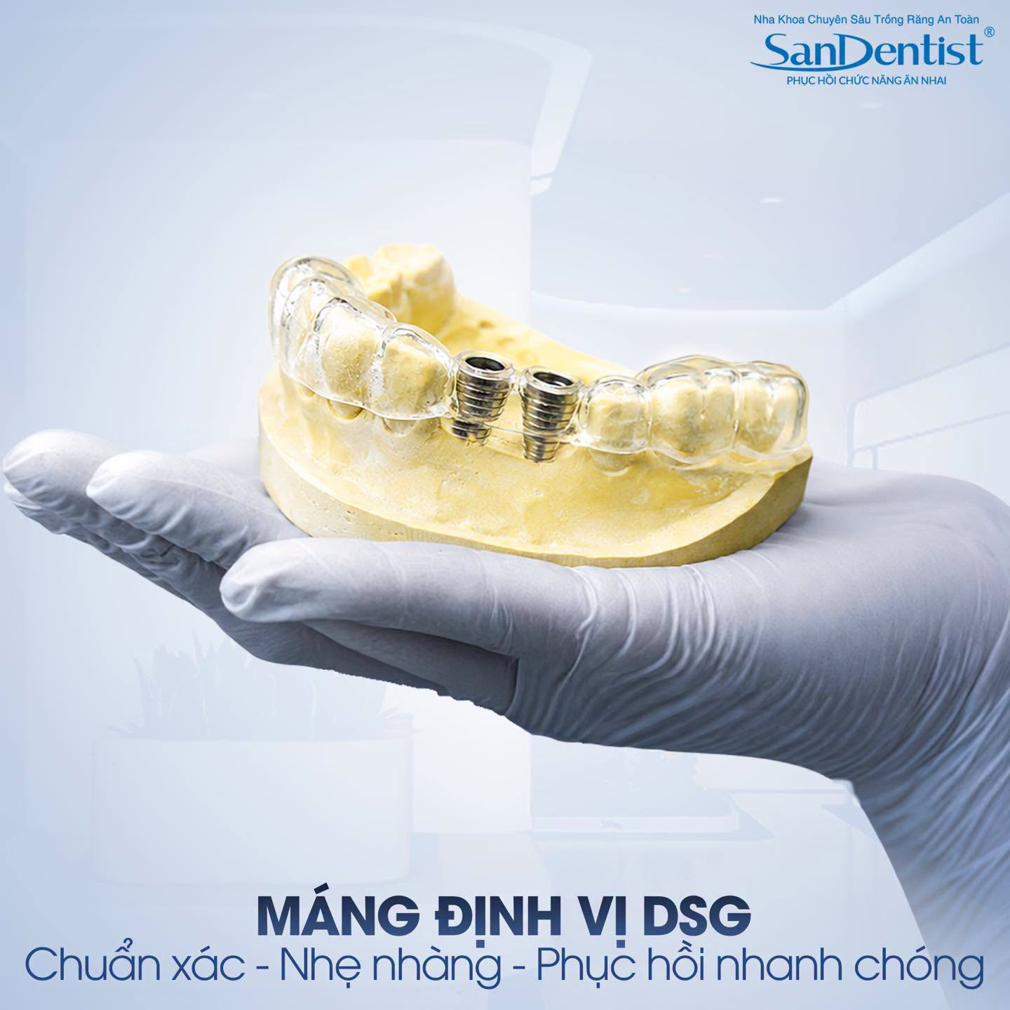 implant vs cầu răng sứ - hình 5