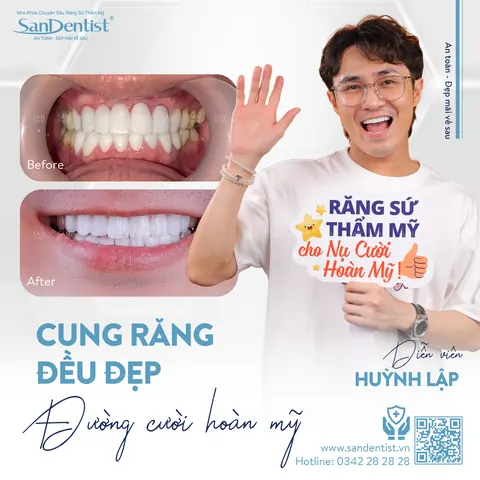 diễn viên Huỳnh Lập - khách hàng San Dentist