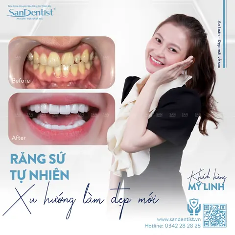 khách hàng Mỹ Linh - khách hàng San Dentist