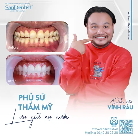 diễn viên Vinh Râu - khách hàng San Dentist