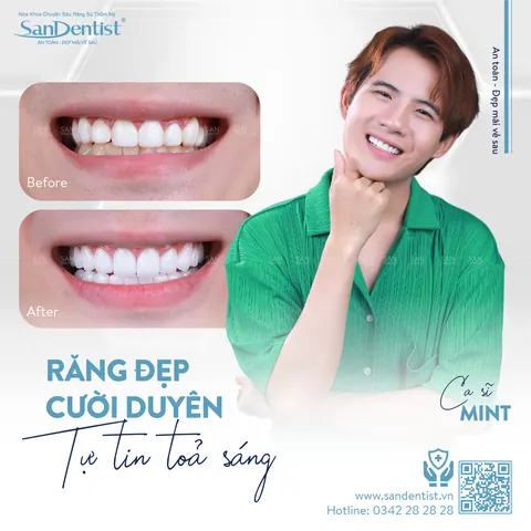 ca sĩ MinT - khách hàng San Dentist