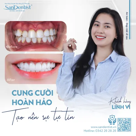 khách hàng Linh Vi - khách hàng San Dentist