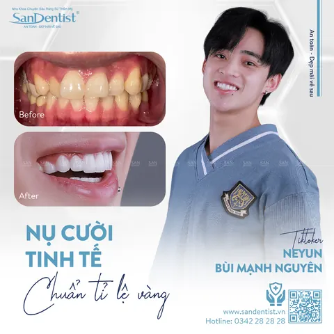Tiktoker Neyun - khách hàng San Dentist