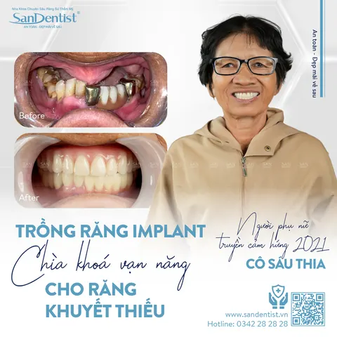 cô Sáu Thia - khách hàng San Dentist