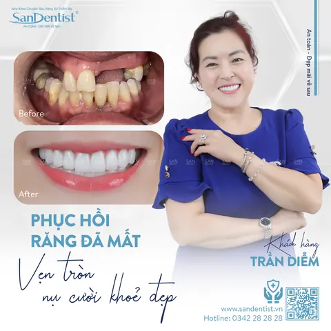cô Diễm Trần (Việt Kiều Mỹ) - khách hàng San Dentist