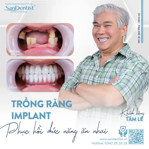 chú Tâm Lê (Việt Kiều Mỹ) - khách hàng San Dentist