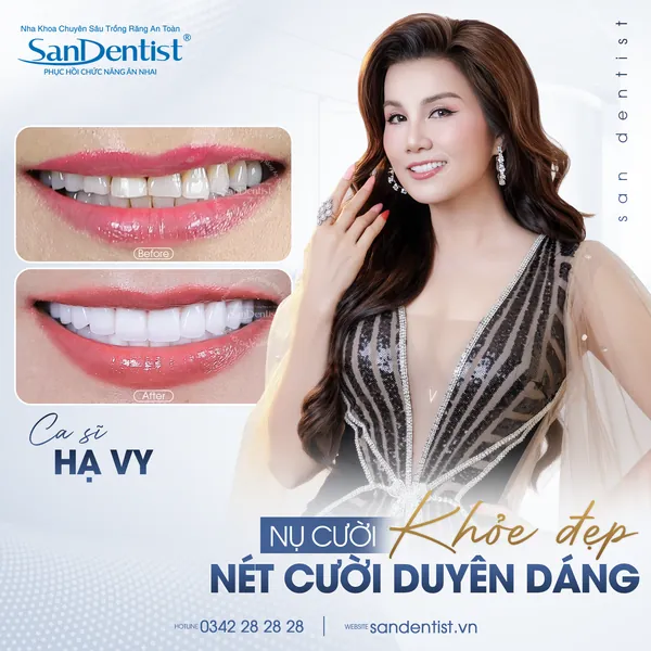 Ca sĩ Hạ Vy - nụ cười trước và sau tại San Dentist