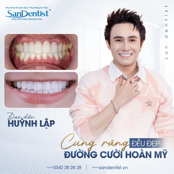 Đạo diễn Huỳnh Lập - nụ cười trước và sau tại San Dentist