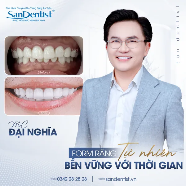 MC Đại Nghĩa - nụ cười trước và sau tại San Dentist