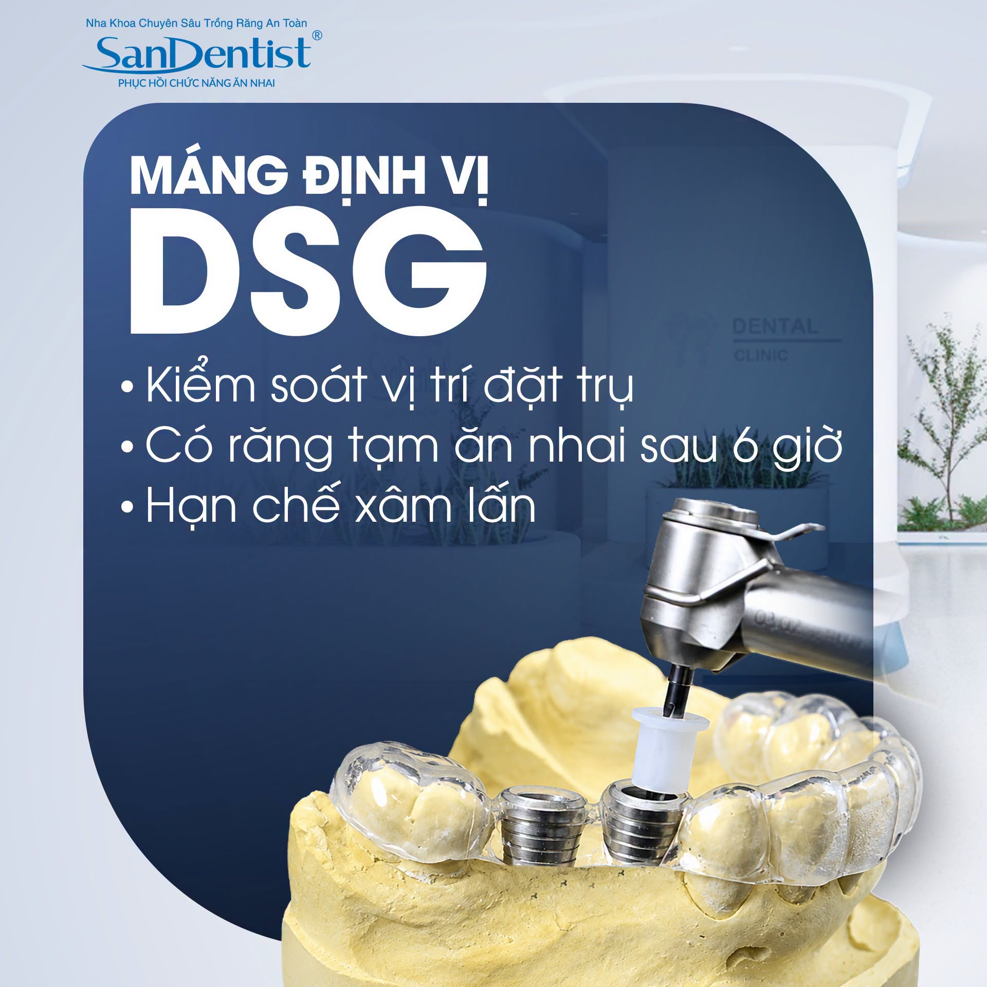 có nên trồng implant - hình 4
