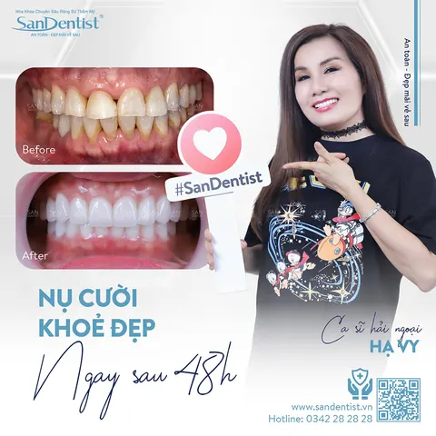 ca sĩ Hạ Vy - khách hàng San Dentist