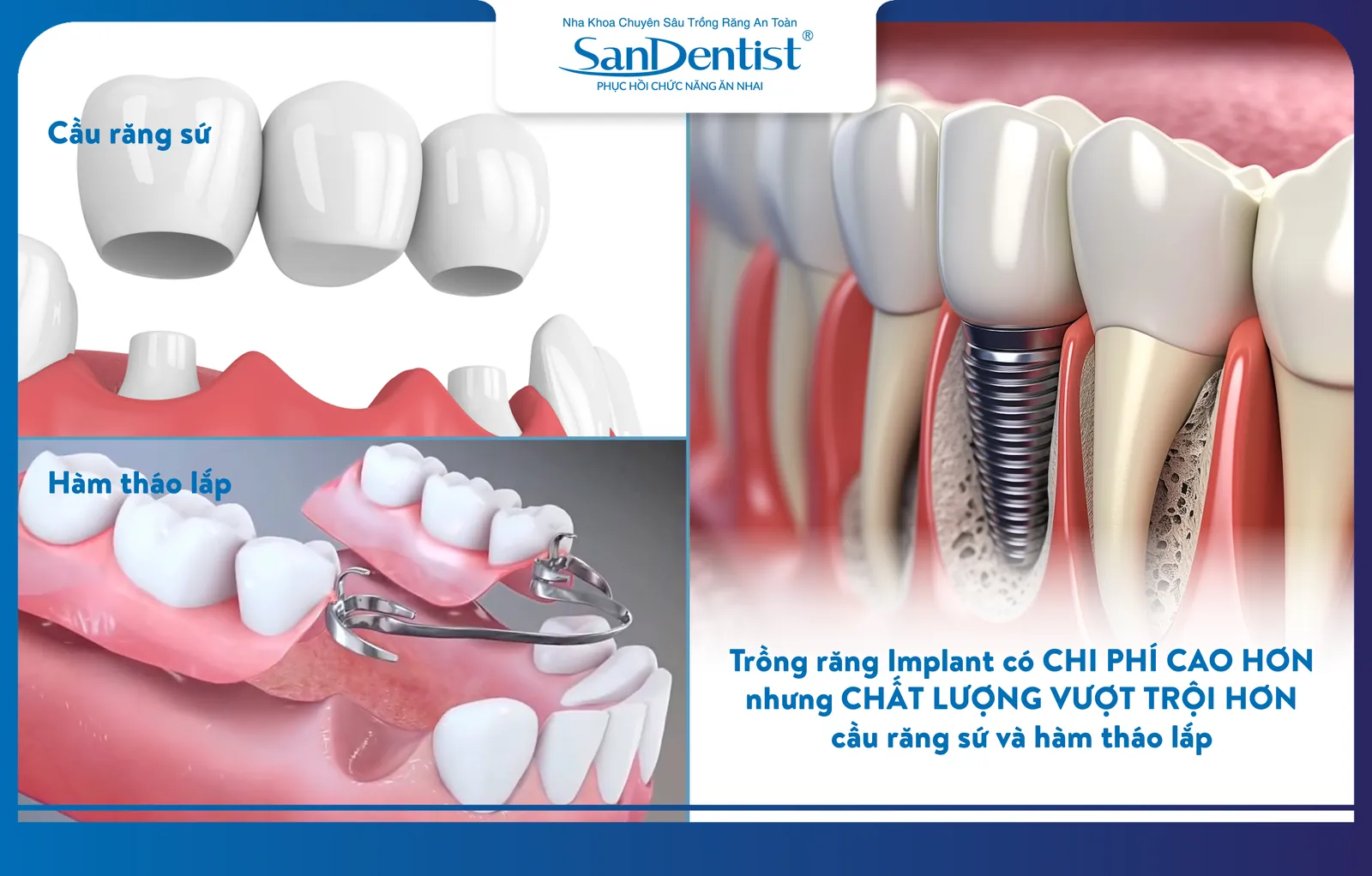 Dental implants are more expensive but offer superior quality compared to other methods