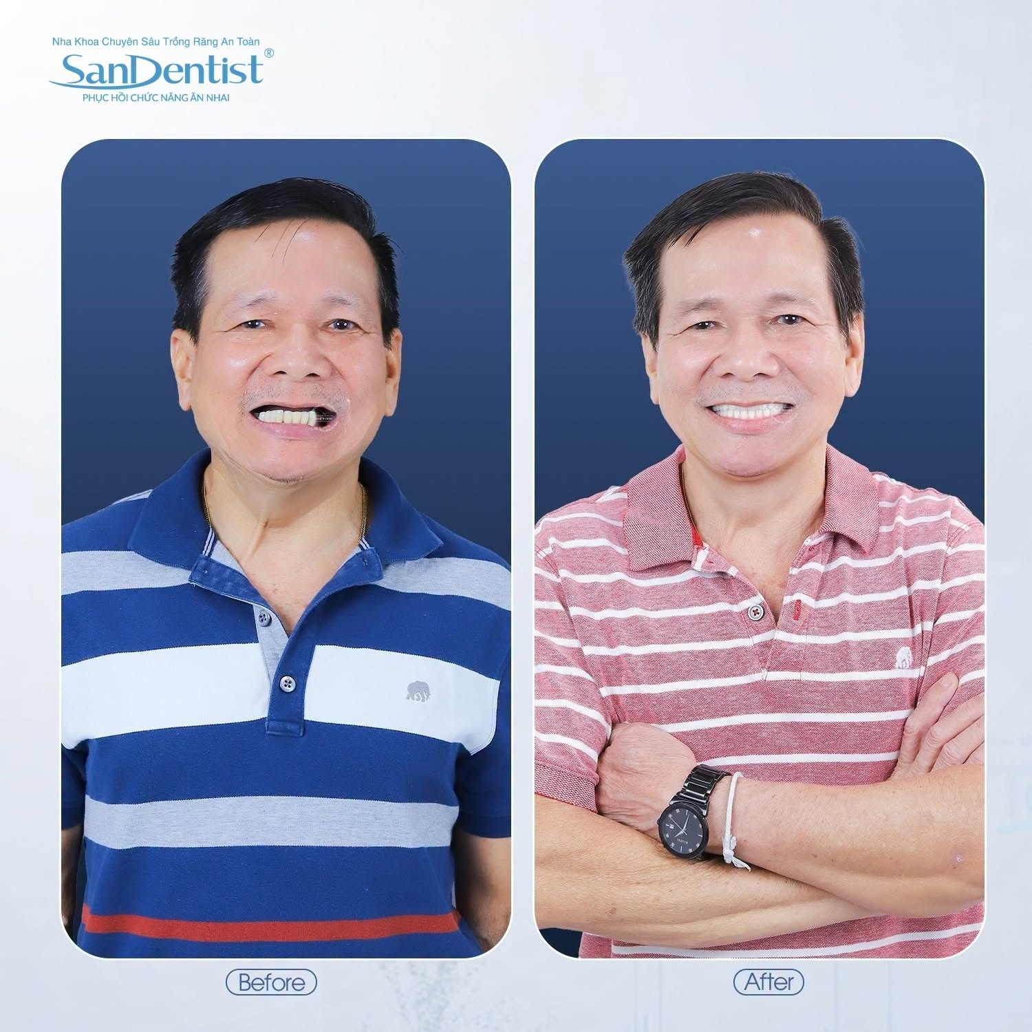trồng implant có đau không - hình 3