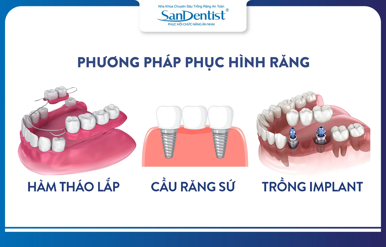 Common methods for restoring missing teeth