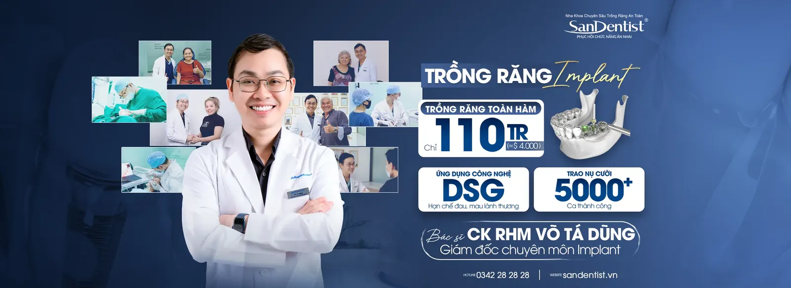 Trồng răng toàn hàm All-on-4 gói Implant 110 triệu - Bác sĩ CK RHM Võ Tá Dũng, máng định vị DSG